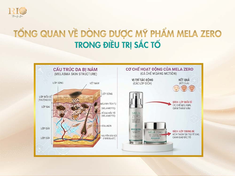 Kem phục hồi da sau laser mela zero dược mỹ phẩm trị nám tàn nhang đỉnh cao tại Thẩm mỹ Rio