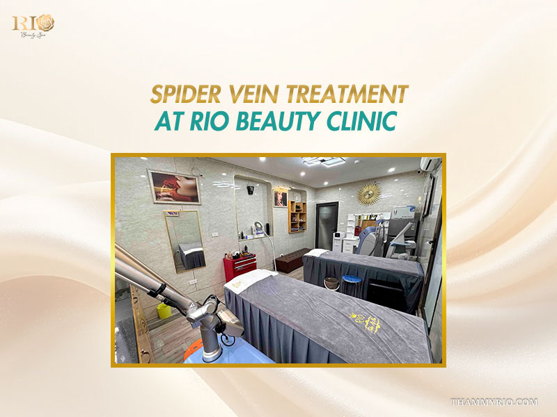 Modern treatment room with advanced laser workstations providing transparent spider vein treatment cost at Rio Beauty Clinic
