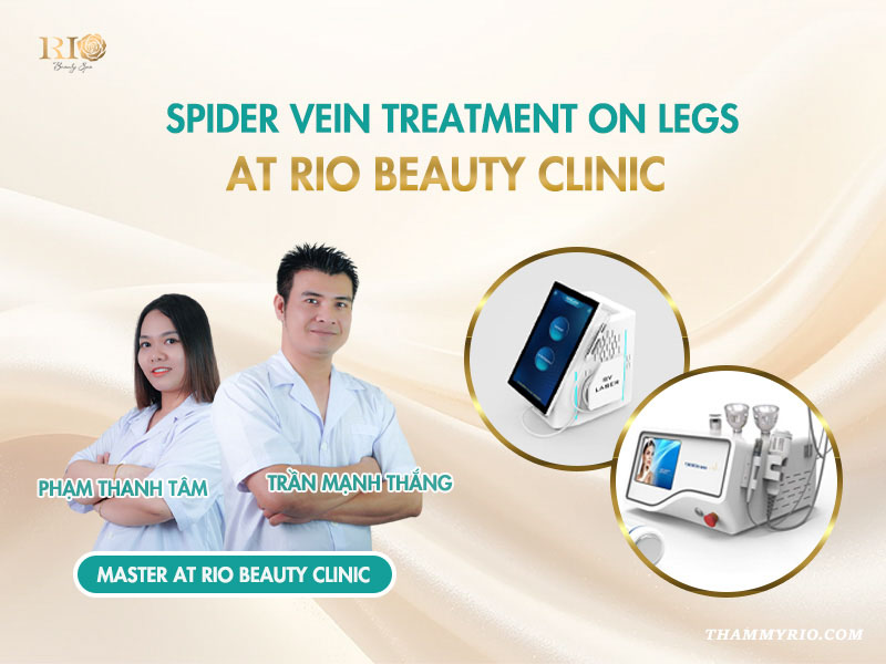 Spider vein treatment on legs at Rio Beauty Clinic