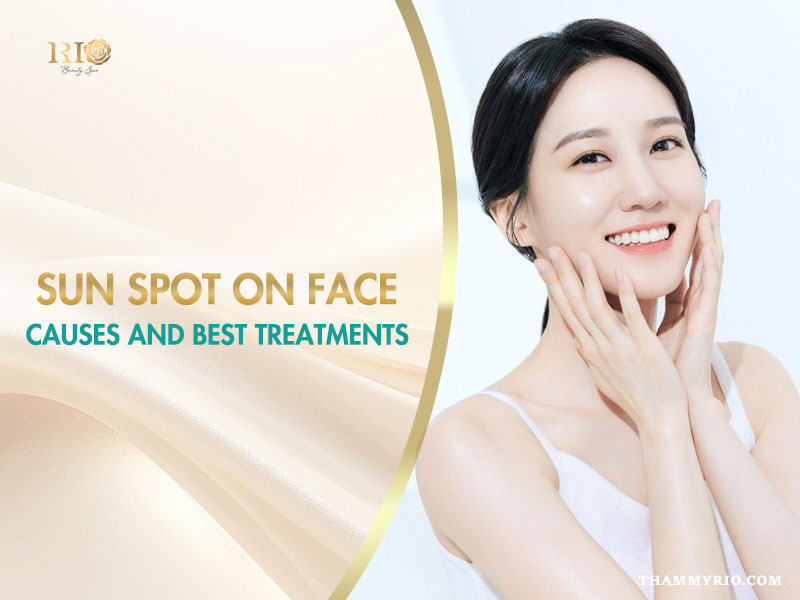 Sun spot on face causes and best treatment options explained