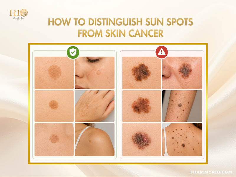 Sun spot on face compared with suspicious skin changes requiring evaluation
