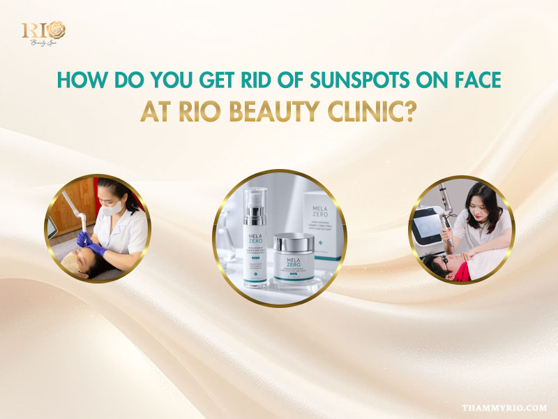 Sun spot on face treatment process at Rio Beauty Clinic