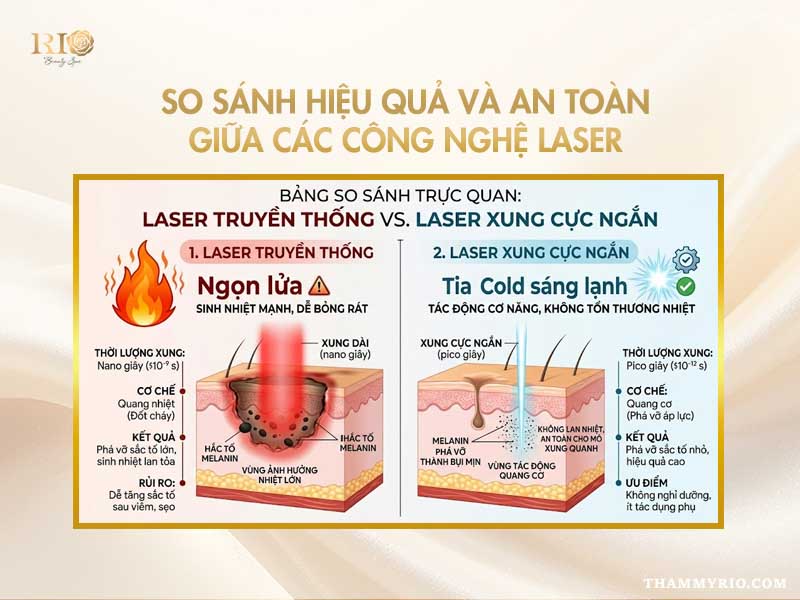 So sánh laser truyền thống và laser xung cực ngắn trị nám