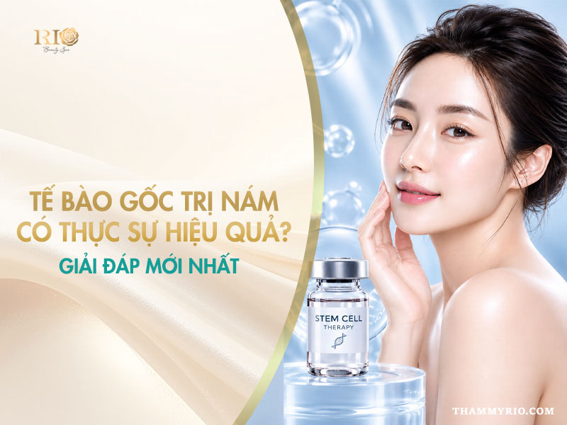 Tế bào gốc trị nám: giải đáp hiệu quả và ứng dụng phục hồi da