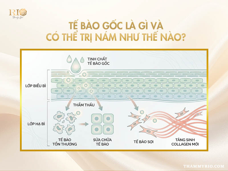 Cơ chế tế bào gốc trị nám qua thẩm thấu và hỗ trợ tái tạo da