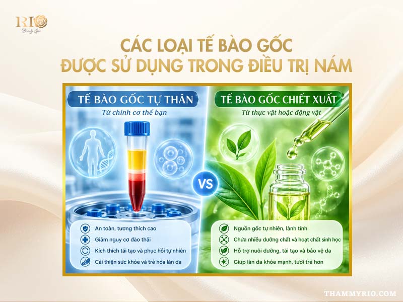 Các loại tế bào gốc được sử dụng trong điều trị nám