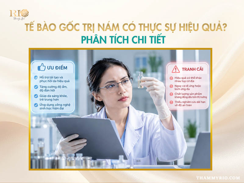 Phân tích hiệu quả tế bào gốc trị nám và những lưu ý