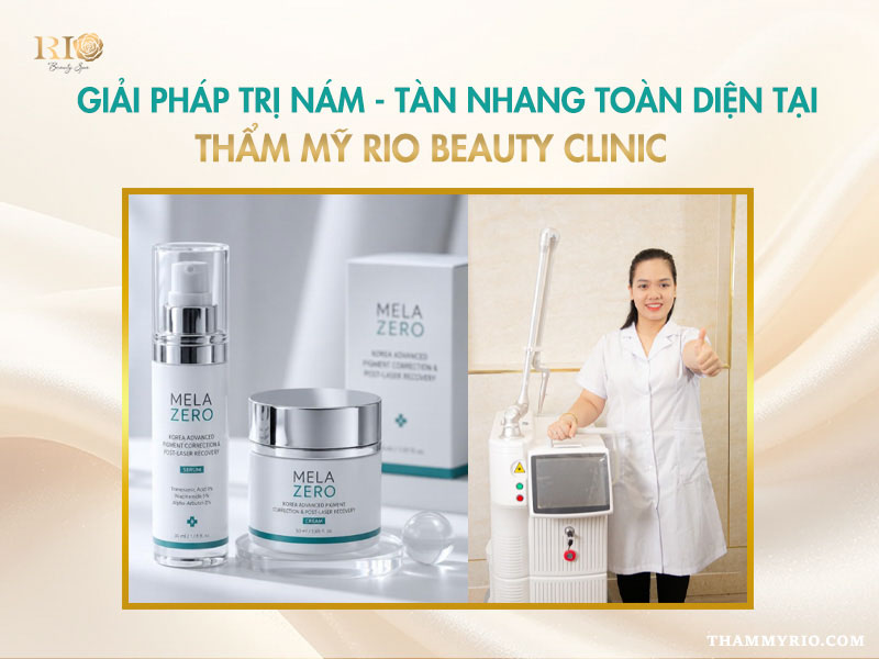 Giải pháp trị nám tàn nhang tại Thẩm mỹ Rio Beauty Clinic