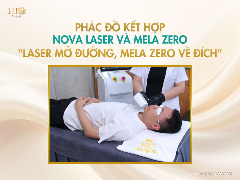 Kỹ thuật viên Thẩm mỹ Rio đang chiếu thiết bị công nghệ cao điều trị nám cho khách hàng nam trên giường spa