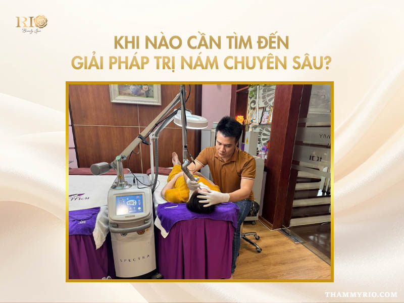 Giải pháp trị nám chuyên sâu bằng công nghệ cao tại Thẩm mỹ Rio.