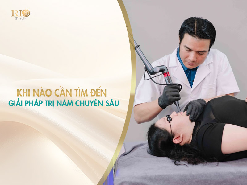 dùng công nghệ laser chuyên sâu khi trị nám tại nhà không hiệu quả.