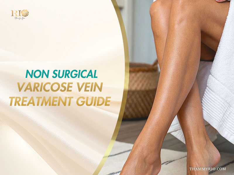 Non surgical varicose vein treatment guide banner