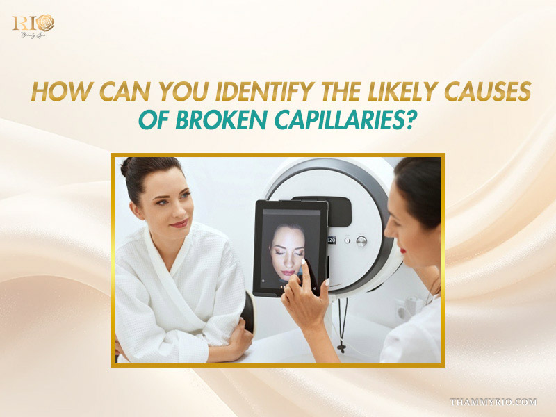 How to identify what causes broken capillaries