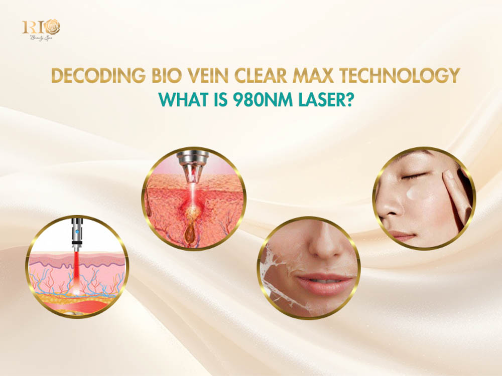 Infographic displaying laser penetration, vascular heating, and epidermal protection mechanisms of Bio Vein Clear Max 980 nm