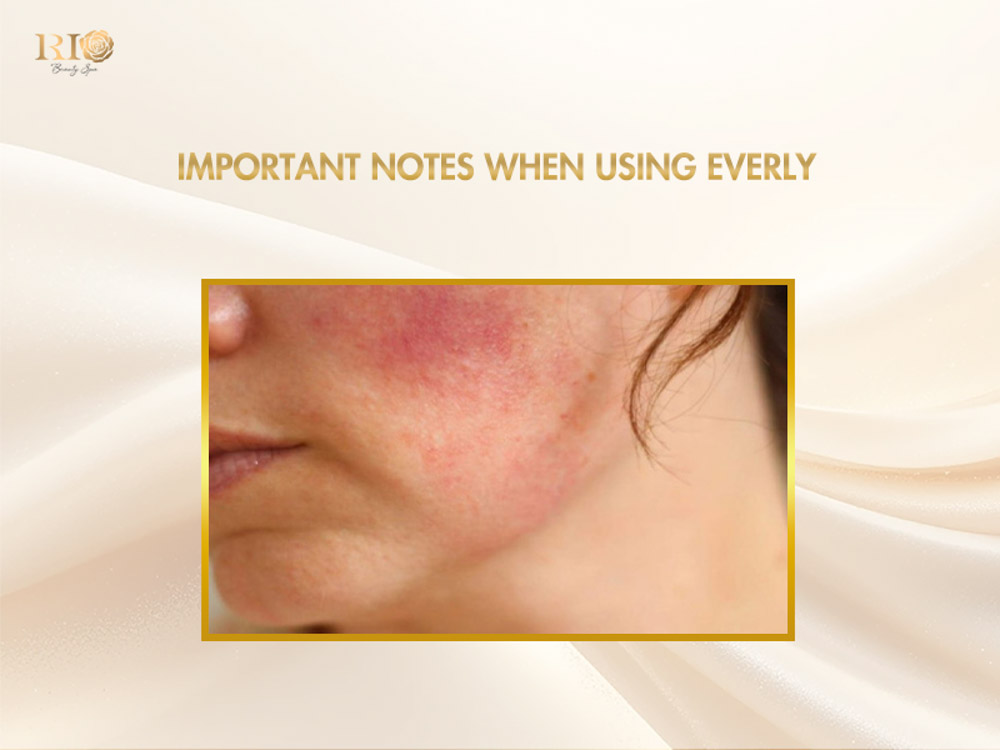 Close-up of erythematous facial skin emphasizing important notes when using Everly post-laser skincare