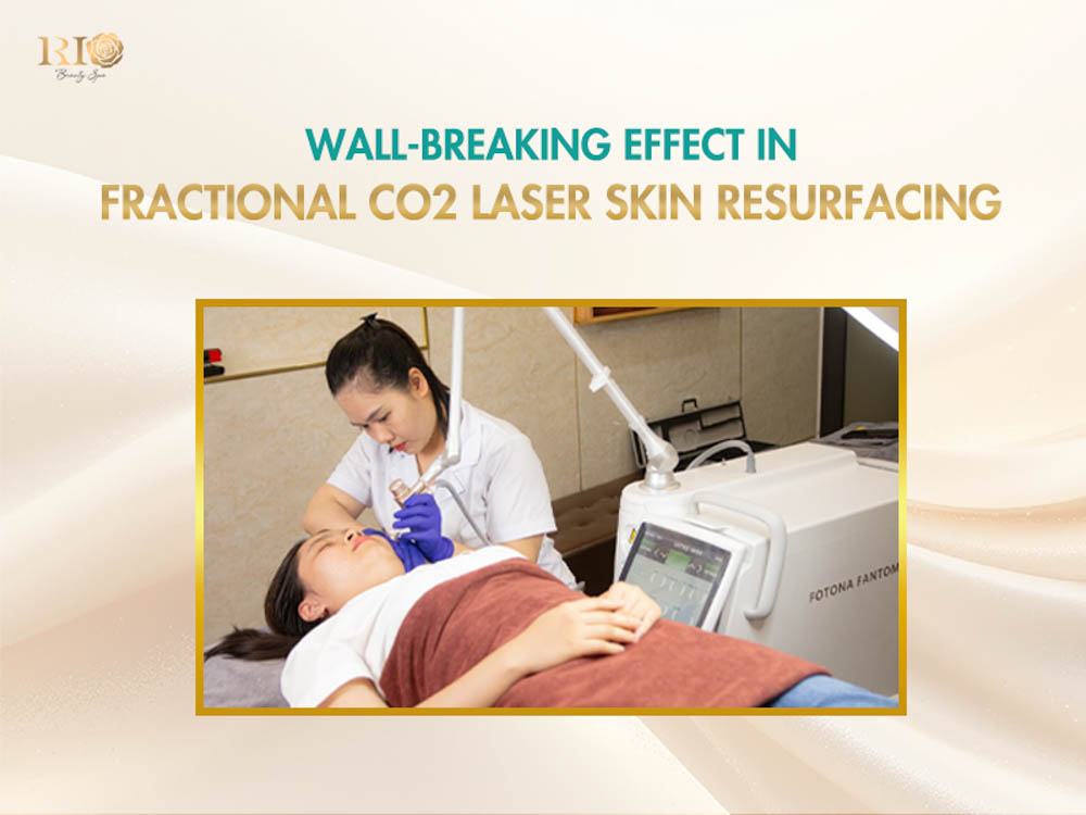 Wall-breaking effect in skin resurfacing with technology Fotona 5D laser CO2 fractional.