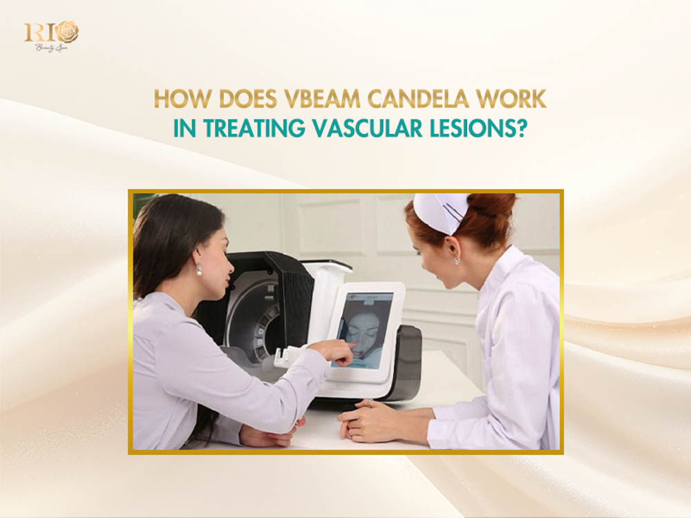 Dermatologist and patient evaluating 3D skin diagnostics to understand how Vbeam Candela 595 nm treats vascular lesions