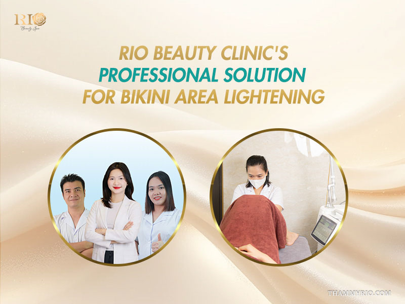 Medical team and laser specialist at Rio Beauty Clinic offering professional bikini area lightening