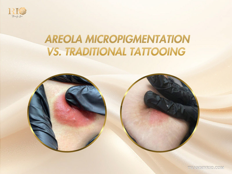Dual circular comparison of healed cosmetic skin results showing areola micropigmentation vs traditional tattooing