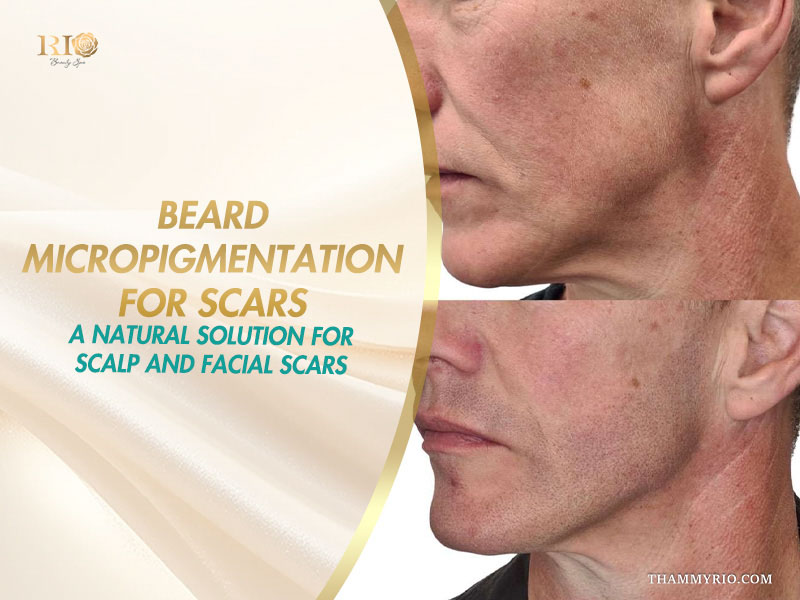 Split before and after comparison of jawline restoration using beard micropigmentation for scars