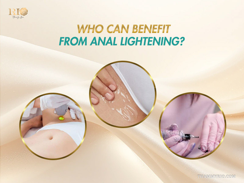 Three circular frames showing laser treatment, cooling gel application, and micro-pigmentation for bleaching the anus