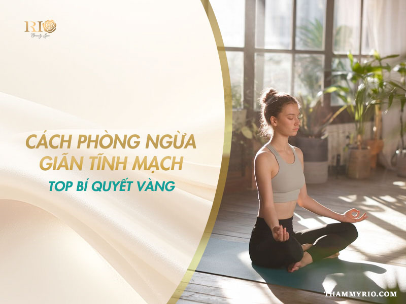 Top bí quyết vàng về cách phòng ngừa giãn tĩnh mạch.