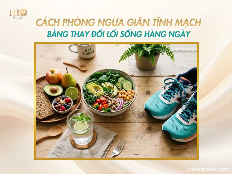 Hướng dẫn cách phòng ngừa giãn tĩnh mạch bằng lối sống.