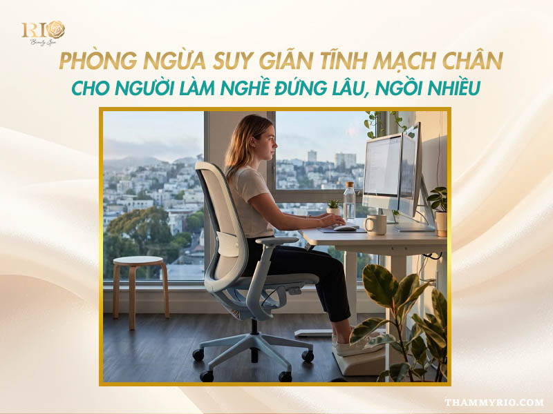 Cách phòng ngừa giãn tĩnh mạch cho dân văn phòng.