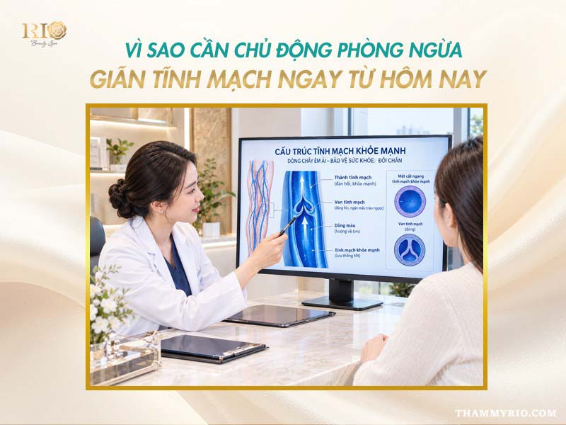 Bác sĩ tư vấn cách phòng ngừa giãn tĩnh mạch chủ động.