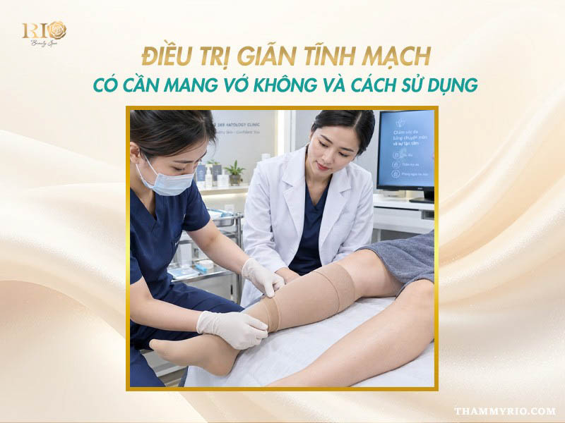 Hướng dẫn mang vớ y khoa khi chăm sóc sau điều trị giãn tĩnh mạch.