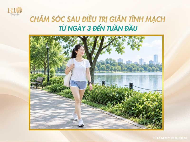Vận động nhẹ nhàng giúp chăm sóc sau điều trị giãn tĩnh mạch hiệu quả.