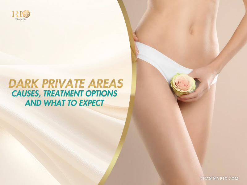 Woman with smooth skin holding a rose on a banner explaining causes and treatment options for dark private areas