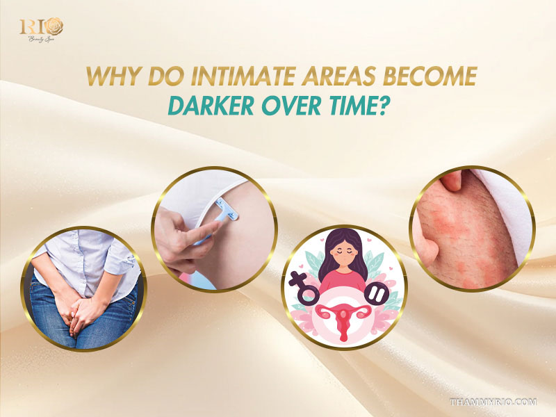 Four circular insets illustrating tight clothing, shaving, hormonal changes, and friction causing dark private areas