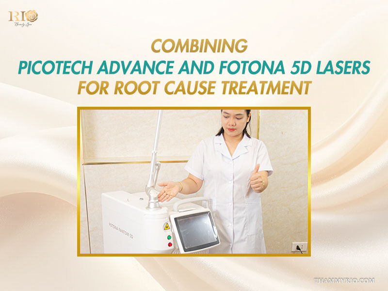 Practitioner introducing the Fotona 5D laser system used alongside Picotech Advance to treat dark private areas