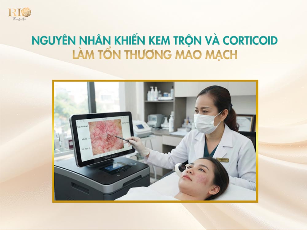Chuyên viên soi da phân tích mạng lưới mạch máu tổn thương để lên phác đồ điều trị giãn mao mạch do corticoid