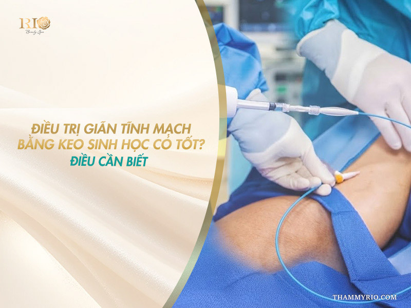Bác sĩ đang thực hiện thao tác can thiệp điều trị giãn tĩnh mạch bằng keo sinh học cho bệnh nhân.