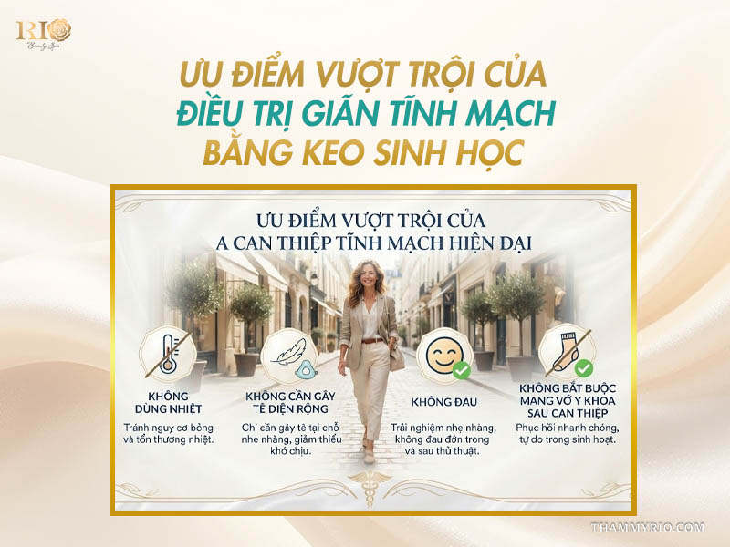 Bốn ưu điểm vượt trội của phương pháp điều trị giãn tĩnh mạch bằng keo sinh học.