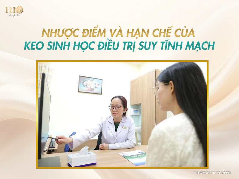 Bác sĩ tư vấn trực tiếp về các nhược điểm khi điều trị giãn tĩnh mạch bằng keo sinh học.