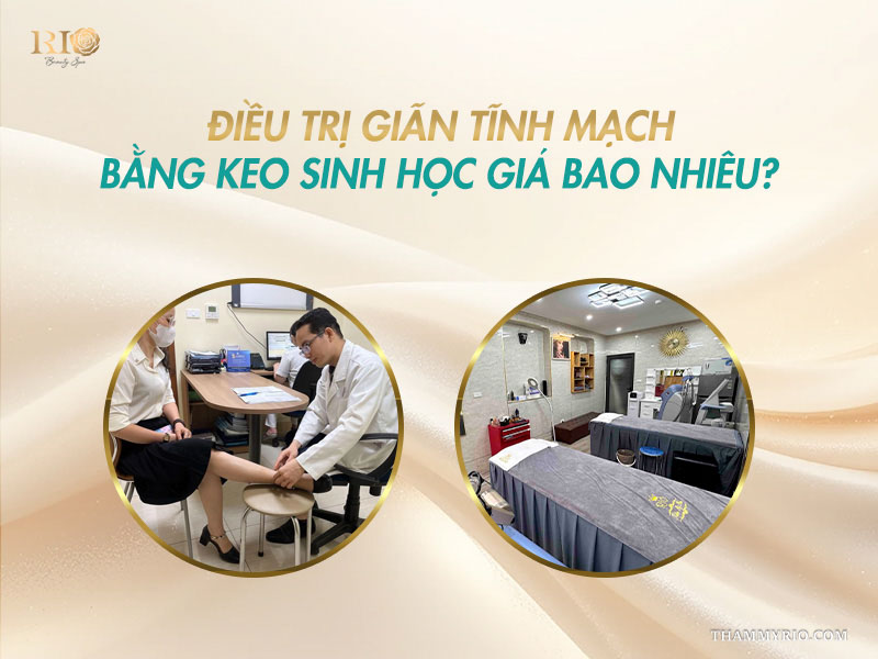 Bác sĩ nam thăm khám chân thực tế để báo giá điều trị giãn tĩnh mạch bằng keo sinh học.
