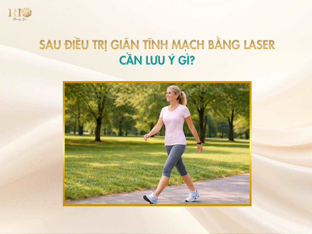 Vận động đi bộ nhẹ nhàng sau khi thực hiện điều trị suy giãn tĩnh mạch bằng laser