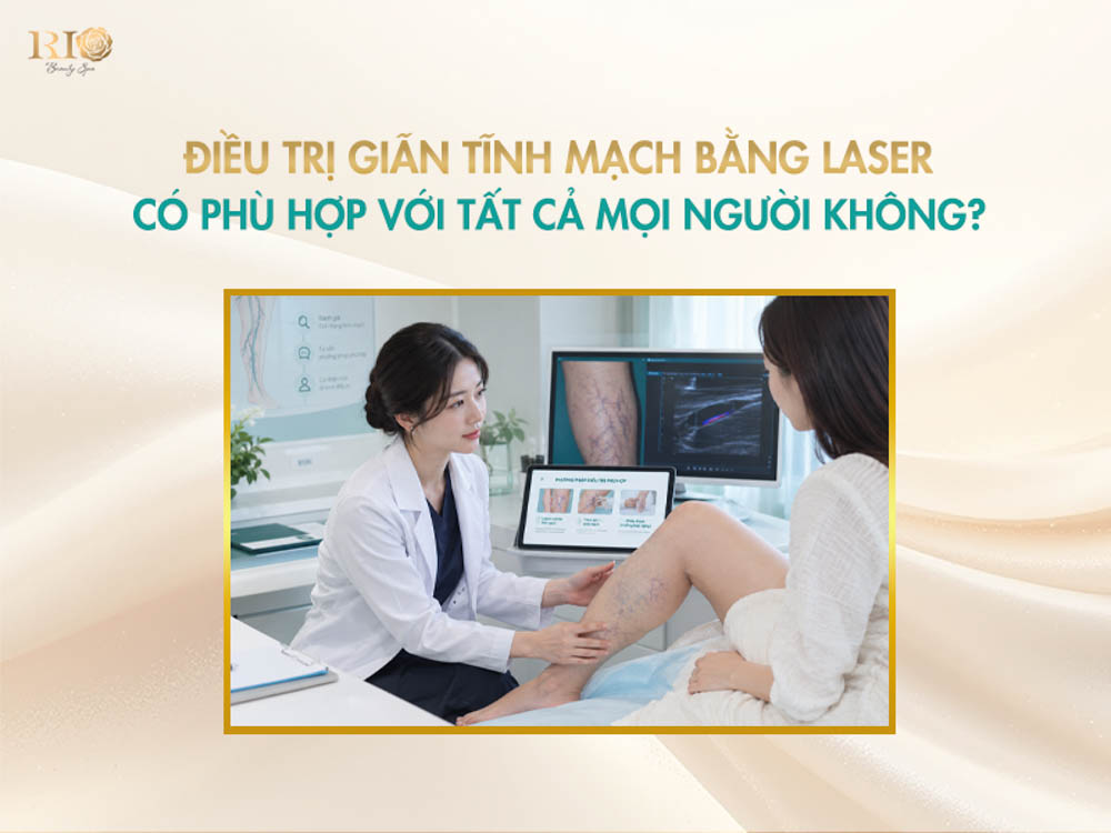 Bác sĩ kiểm tra mức độ nổi gân mạng nhện để tư vấn điều trị suy giãn tĩnh mạch bằng laser