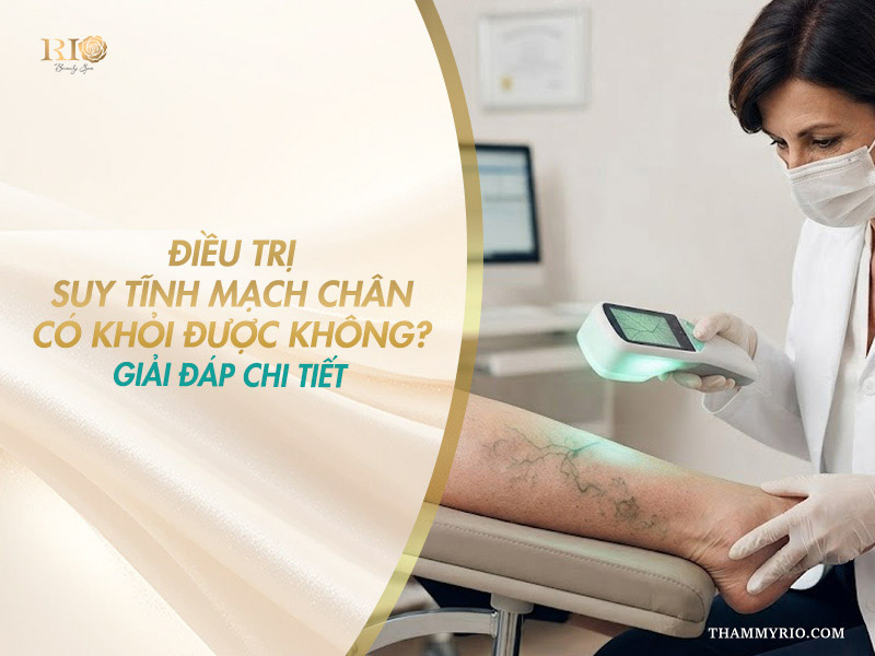 Chuyên viên dùng máy soi mạch phát hiện dòng tĩnh mạch nổi giải đáp điều trị suy tĩnh mạch chân có khỏi được không