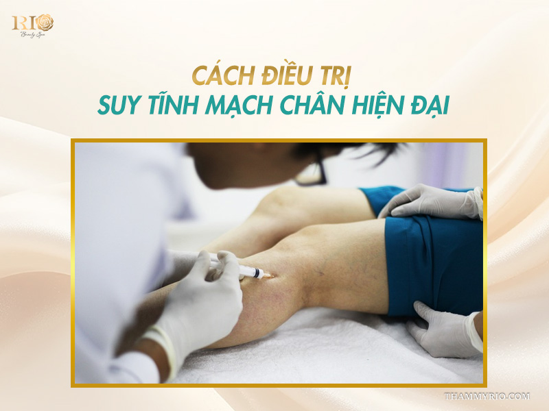 Bác sĩ thực hiện tiêm xơ vi điểm hỗ trợ điều trị suy tĩnh mạch chân hiện đại