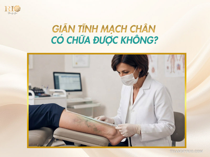 Bác sĩ đo đạc chu vi cẳng chân tư vấn liệu trình điều trị suy tĩnh mạch chân có chữa được không
