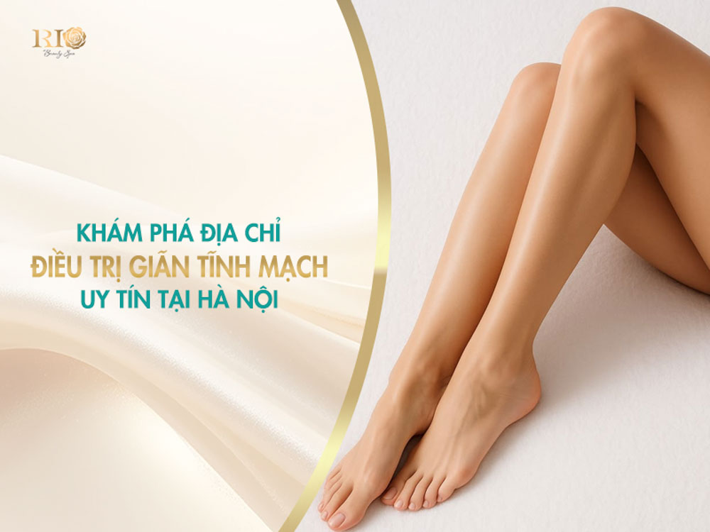 Cập nhật giá điều trị giãn tĩnh mạch tại địa chỉ uy tín ở Hà Nội.