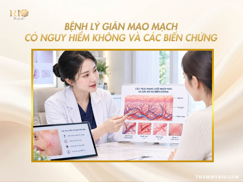 Tìm hiểu bệnh lý giãn mao mạch có nguy hiểm không và các biến chứng.