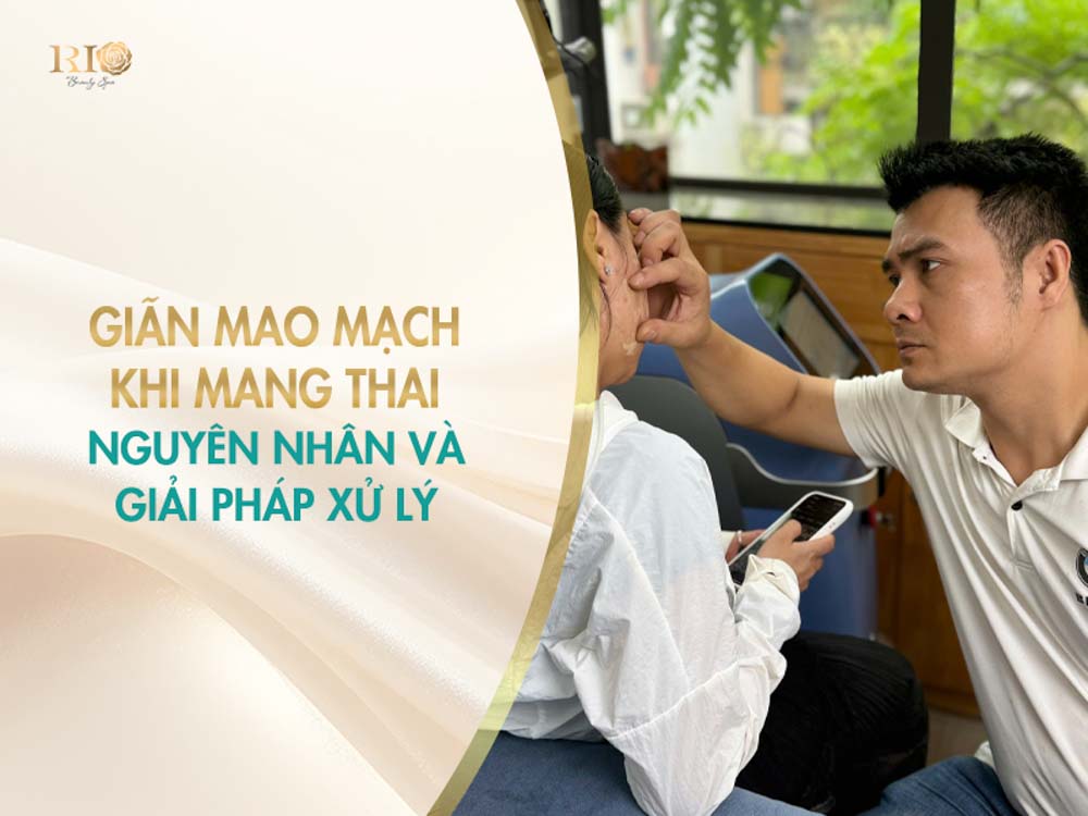 Chuyên gia thăm khám tình trạng giãn mao mạch khi mang thai để tư vấn giải pháp xử lý an toàn