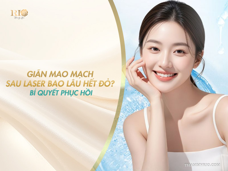 Chuyên gia giải đáp giãn mao mạch sau laser bao lâu hết đỏ và bí quyết phục hồi da.