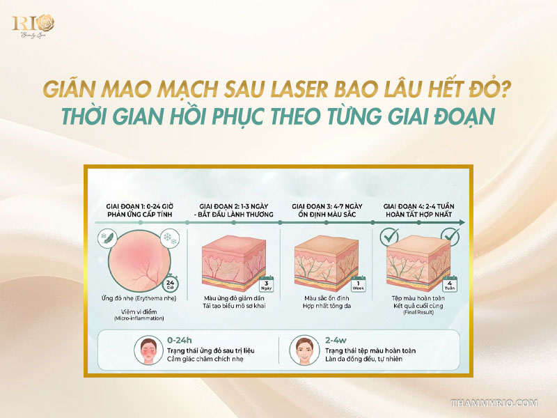 Cẩm nang chi tiết về giãn mao mạch sau laser bao lâu hết đỏ theo từng giai đoạn hồi phục.