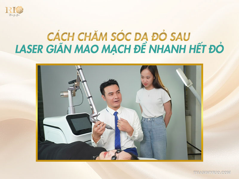 Rio hướng dẫn cách chăm sóc da để biết giãn mao mạch sau laser bao lâu hết đỏ.
